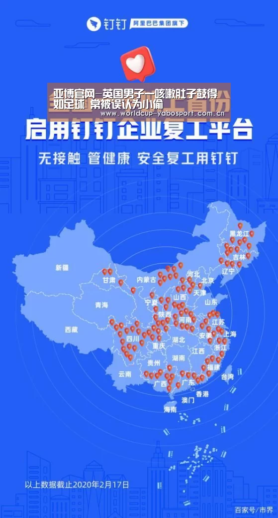 亚博官网-英国男子一咳嗽肚子鼓得如足球 常被误认为小偷(图2) 亚博体育官网